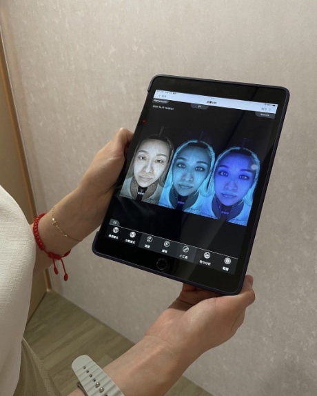 皮秒蜂巢雷射示意