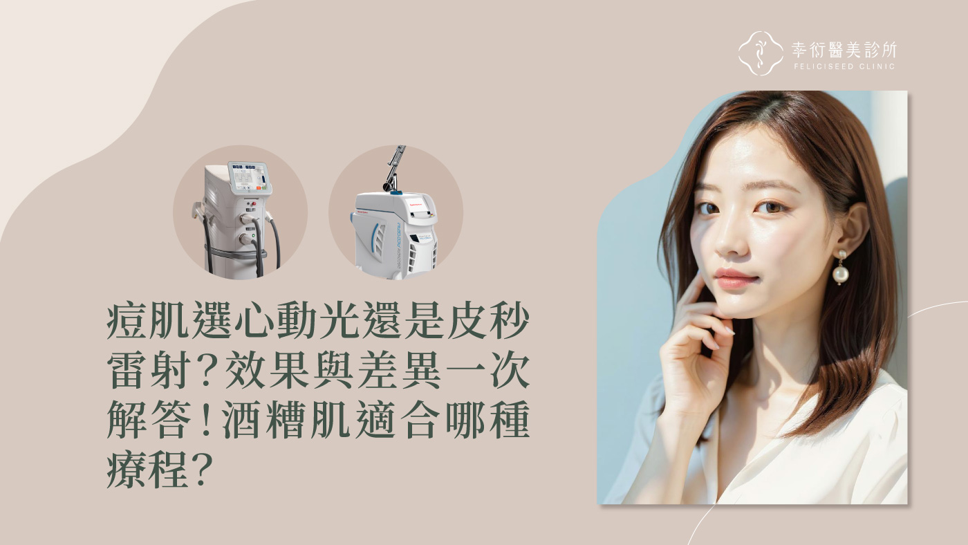 痘肌選心動光還是皮秒雷射？效果與差異一次解答！酒糟肌適合哪種療程？