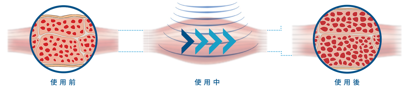 HIFEM 作用深度示意